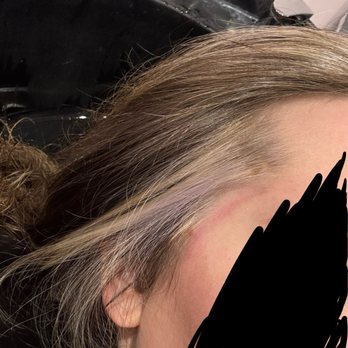 KayCam Hair - White/purple fried hair on my temple and a chemical burn from the products she used with poor application. - Hair Stylists Near Me - Medina, Ohio KayCam Hair - White/purple fried hair on my temple and a chemical burn from the products she used with poor application. - Hair Stylists Near Me - Medina, Ohio