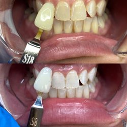 Platinum Smiles