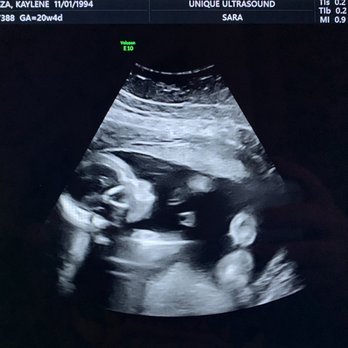 Unique Ultrasound - Diagnostic Imaging Near Me - Temecula, California Unique Ultrasound - Diagnostic Imaging Near Me - Temecula, California