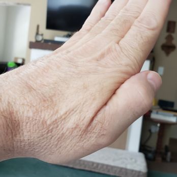 Evergreen Wellness Center - Fingers together arched back hand. - Acupuncture Near Me - Wichita, Kansas