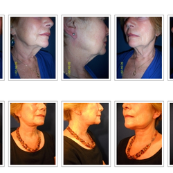 Karen Singer, MD