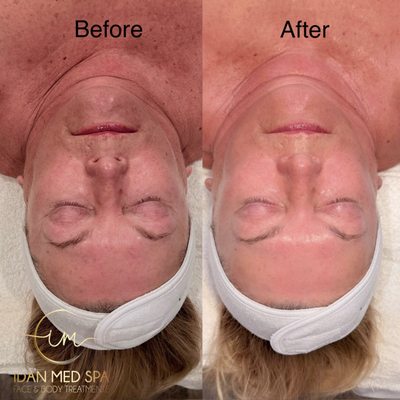Idan Med Spa by null