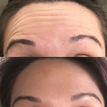 Contour You - Contour You - Medical Spas Near Me - Scottsdale, Arizona Contour You - Contour You - Medical Spas Near Me - Scottsdale, Arizona