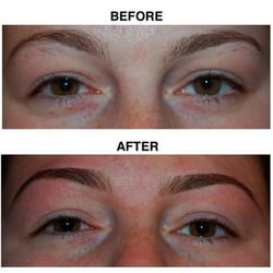 Metamorphosis Electrolysis