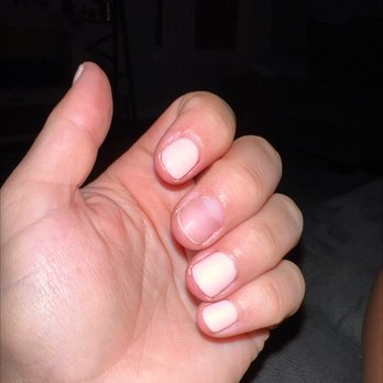 Modish Nails & Spa - My gel nail peeled off within hours of manicure - Nail Salons Near Me - Jacksonville, Florida Modish Nails & Spa - My gel nail peeled off within hours of manicure - Nail Salons Near Me - Jacksonville, Florida