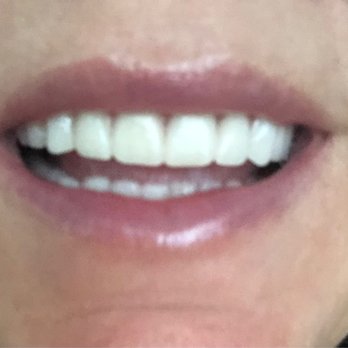 Great Smile Denture Clinic - My beautiful smile - Health & Medical Near Me - Scarborough, Ontario