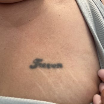 LaserAway - Medical Spas Near Me - Phoenix, Arizona