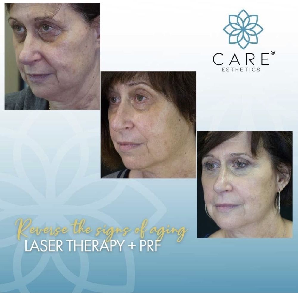 CARE Esthetics Los Angeles - sleep specialist in Los Angeles, CA