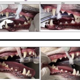 Teeth Cleaning Procedure Teeth Cleaning Procedure