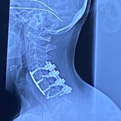 Wayne Cheng, MD - Bone & spine Surgery