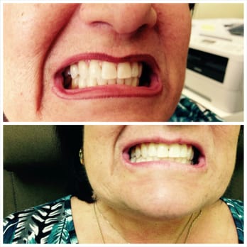 Bright Smiles 4 U - Teeth Whitening Near Me - Tampa, Florida Bright Smiles 4 U - Teeth Whitening Near Me - Tampa, Florida