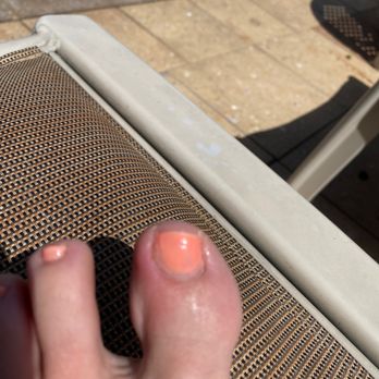 La Miranda Nails & Spa - See the left side of big toe, it now is infected two days later. - Skin Care Near Me - Marco Island, Florida