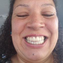Beim Orthodontics - Removed a permanent retainer and made me a new one in less than 24 hours. Excellent customer service!
