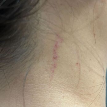 New Four Seasons Spa - Neck scratch from "massage". - Massage Near Me - Fort Lee, New Jersey