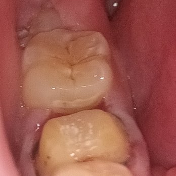 Thuận Nguyễn ANISHA NGUYEN, DDS - MILE SQUARE PARK FAMILY DENTAL GROUP