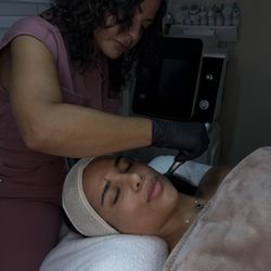 GoWell Med Spa - Microneedling in progress
