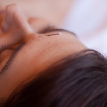 Centerpath Wellness - Acupuncture Near Me - Austin, Texas Centerpath Wellness - Acupuncture Near Me - Austin, Texas