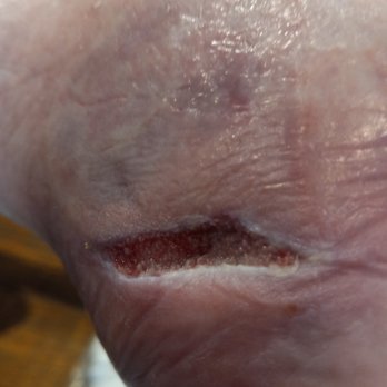 Elite Foot & Ankle: Kellvan J. Cheng, DPM, FACFAS - Podiatrists Near Me - Carrollton, Texas Elite Foot & Ankle: Kellvan J. Cheng, DPM, FACFAS - Podiatrists Near Me - Carrollton, Texas