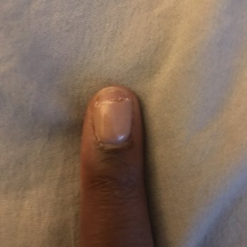 Apple Valley Nails - Nail broke 3 days after getting a fresh set - Nail Salons Near Me - Apple Valley, California Apple Valley Nails - Nail broke 3 days after getting a fresh set - Nail Salons Near Me - Apple Valley, California