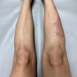 Unbare Me - Lower Leg Wax | BEFORE