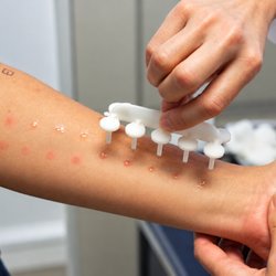Aspire Allergy & Sinus - Allergy Test