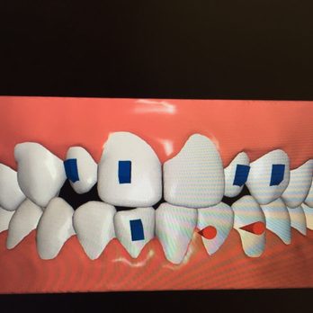 Steele Dentistry - After 2 years of treatment and 3500 dollars... - General Dentistry Near Me - Denver, Colorado