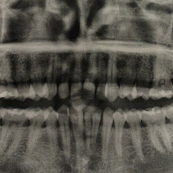 Linda Miyatake, DDS, MD - After - Oral Surgeons Near Me - San Mateo, California