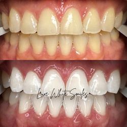 Luxe White Smiles