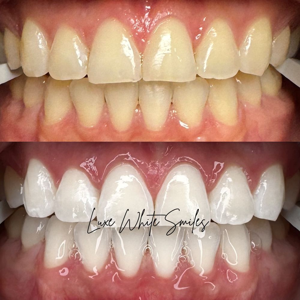 Luxe White Smiles Logo