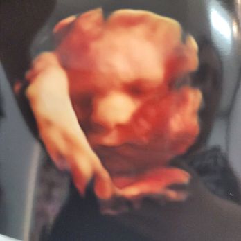 Maternity Imaging - Ultrasound Imaging Centers Near Me - Glendale, California Maternity Imaging - Ultrasound Imaging Centers Near Me - Glendale, California