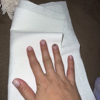 i Touch Day Spa - Nail fungus - Nail Salons Near Me - Tucson, Arizona i Touch Day Spa - Nail fungus - Nail Salons Near Me - Tucson, Arizona