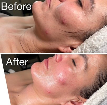 Facials - Book online today:https://www.styleseat.com/m/p/jennifermoreno7
Or give us a call at:9513308069 Facials - Book online today:https://www.styleseat.com/m/p/jennifermoreno7
Or give us a call at:9513308069