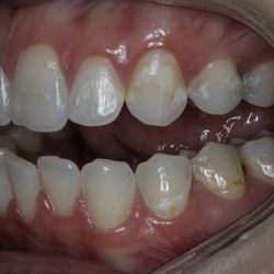 Serene Oaks Dental - Before photo!