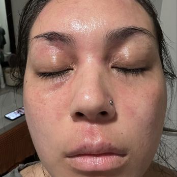 Dr. Mona Mofid, Dermatologist - Me before Dr. Natalie - Dermatologists Near Me - Coronado, California