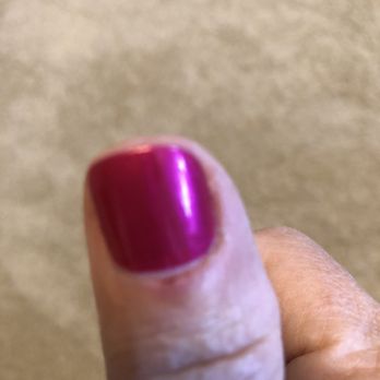 Essence Nail Lounge - Cut bleeding swollen scabbed cuticle - Nail Salons Near Me - Denver, Colorado Essence Nail Lounge - Cut bleeding swollen scabbed cuticle - Nail Salons Near Me - Denver, Colorado