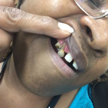 Taco Bell - My tooth hanging - Fast Food Near Me - Memphis, Tennessee Taco Bell - My tooth hanging - Fast Food Near Me - Memphis, Tennessee
