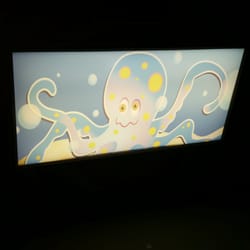 LeBonheur East Surgery Center - Cool ceiling lights