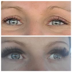 JK Skincare & Spa - Before and after with Jackie!