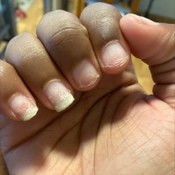 Element Nail Bar - My nails after 3 weeks and me taking them off! Ripped my nails - Nail Salons Near Me - Phoenix, Arizona Element Nail Bar - My nails after 3 weeks and me taking them off! Ripped my nails - Nail Salons Near Me - Phoenix, Arizona