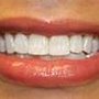 Photo of Tacoma Prosthodontics