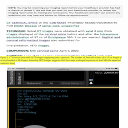 Touchstone Imaging North Austin - 80 images w/wo contrast are normal for a 15 cm scan length with 3mm sections. 1873 images seem to be consistent with the 10-20 CT rotation.