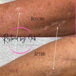 White scar camouflage on forearm