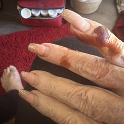 Adopt a pet - My hand after the dog bit me.