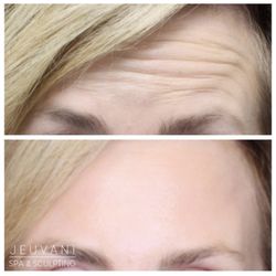 Jeuvani Spa and Sculpting