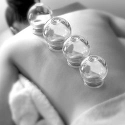 Cupping Therapy