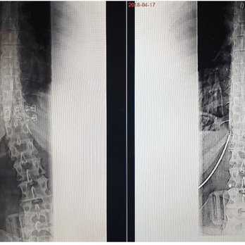 Divine Spine - Before/After - Chiropractors Near Me - Yorba Linda, California Divine Spine - Before/After - Chiropractors Near Me - Yorba Linda, California