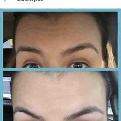 Skin Envy Aesthetics Mobile Botox