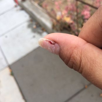 AP Nails - Did not listen when I requested to soak and literally kept clipping at the nail to try and take it off to be "quick" - Nail Salons Near Me - Long Beach, California