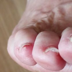 Red Nails - Toes after pedicure