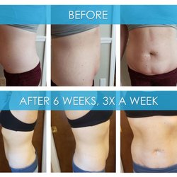 Physicians WEIGHT LOSS Centers
